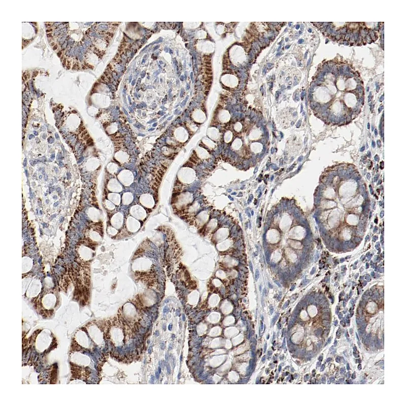 Atlas Antibodies Anti-SETD3 Antibody