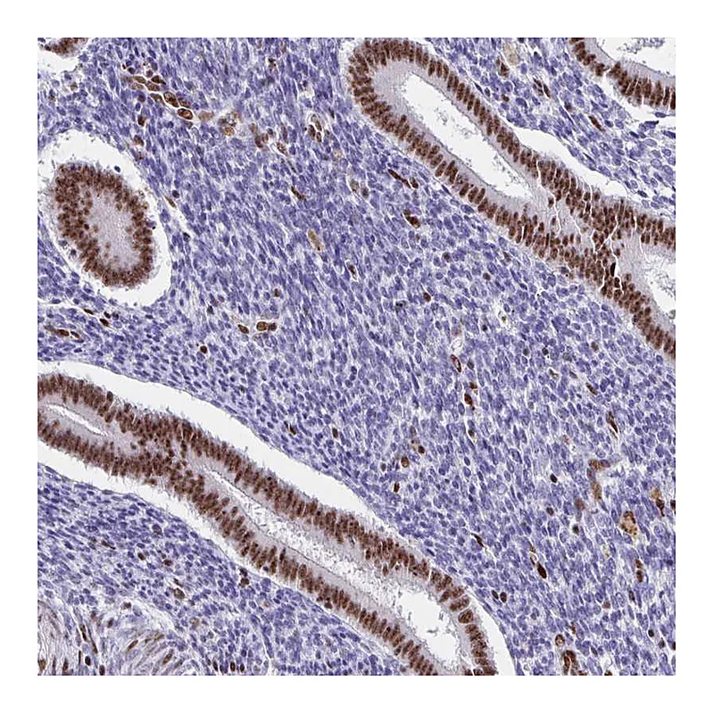 Atlas Antibodies Anti-SETD5 Antibody