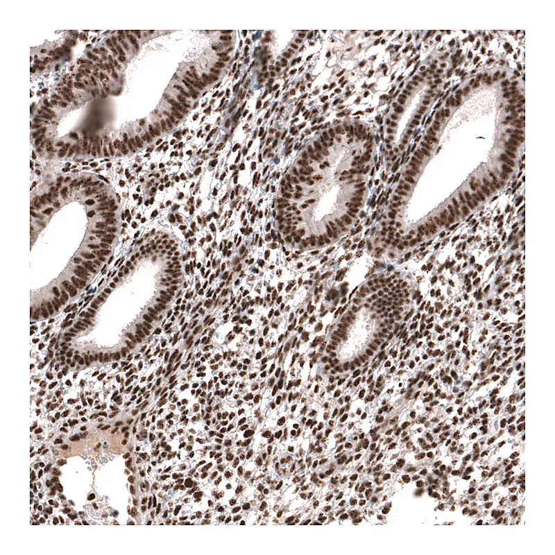 Atlas Antibodies Anti-SETD2 Antibody