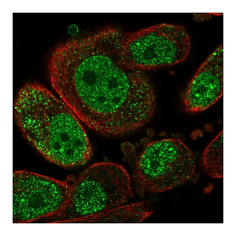 Atlas Antibodies Anti-SETD6 Antibody