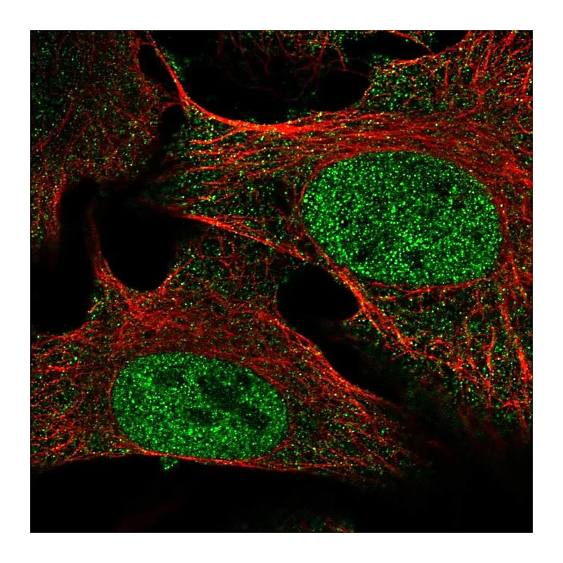 Atlas Antibodies Anti-SETDB2 Antibody