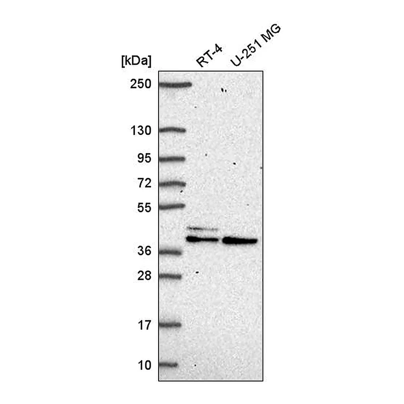 Atlas Antibodies Anti-SETMAR Antibody