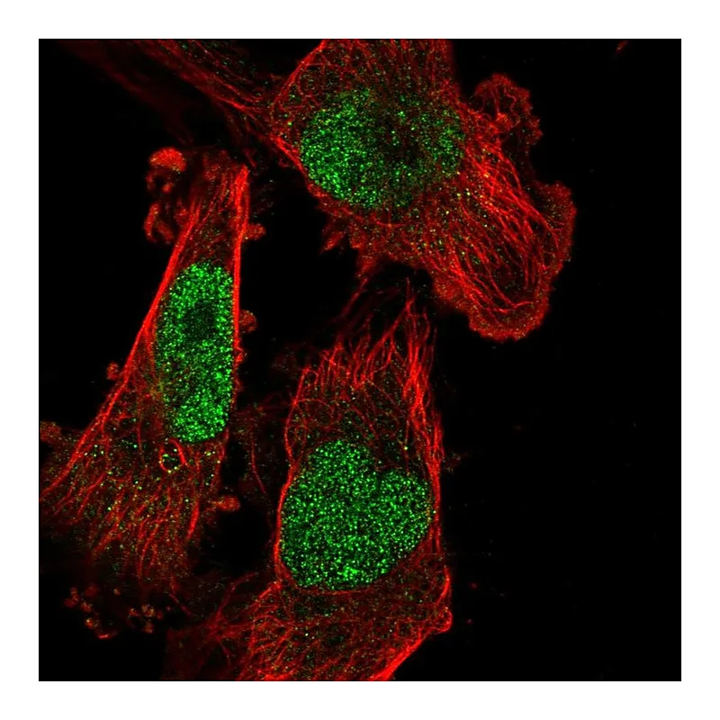 Atlas Antibodies Anti-SETDB1 Antibody