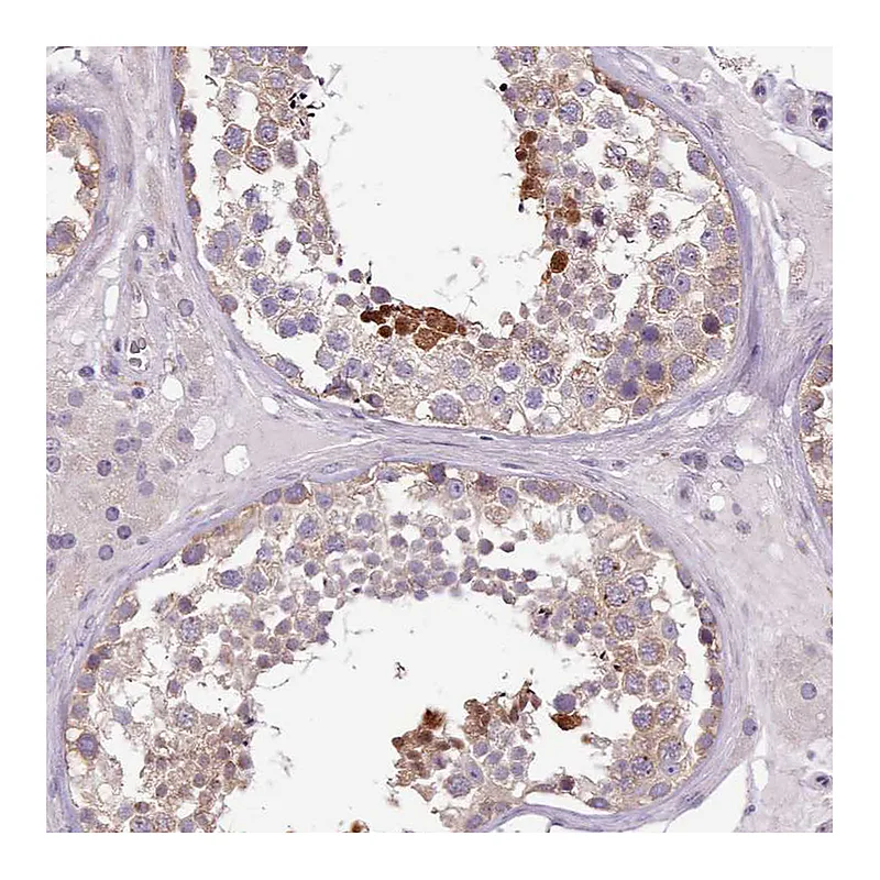 Atlas Antibodies Anti-SETX Antibody