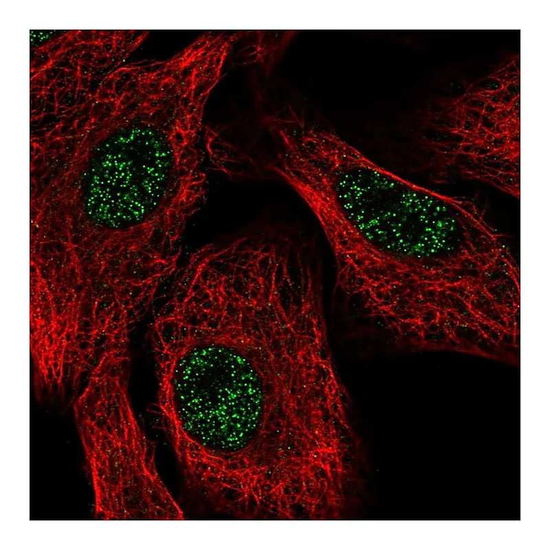 Atlas Antibodies Anti-SETX Antibody