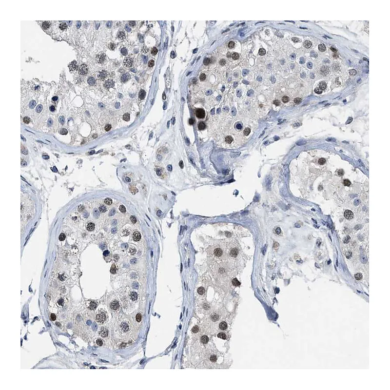Atlas Antibodies Anti-SETDB1 Antibody
