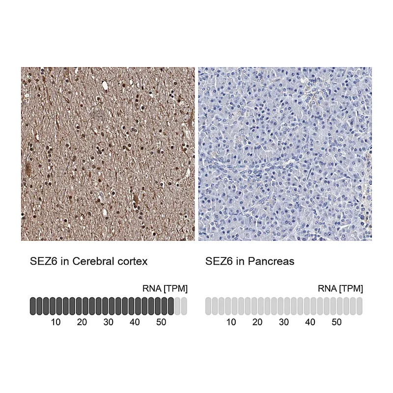 Atlas Antibodies Anti-SEZ6 Antibody