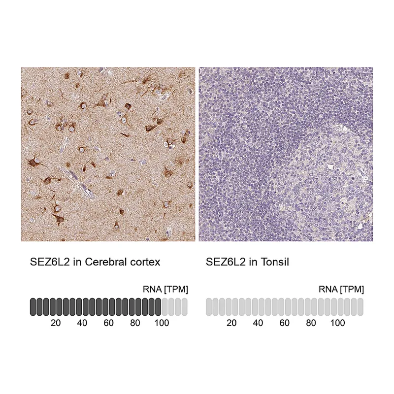 Atlas Antibodies Anti-SEZ6L2 Antibody