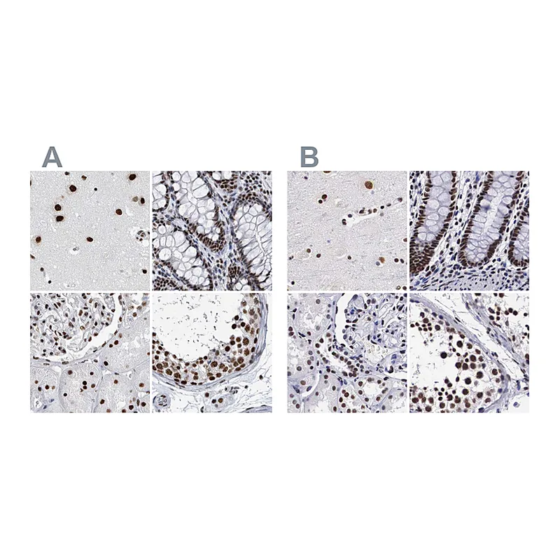 Atlas Antibodies Anti-SF3A1 Antibody