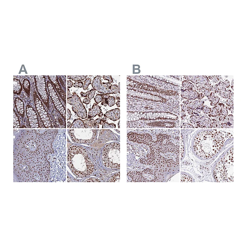 Atlas Antibodies Anti-SF3A2 Antibody