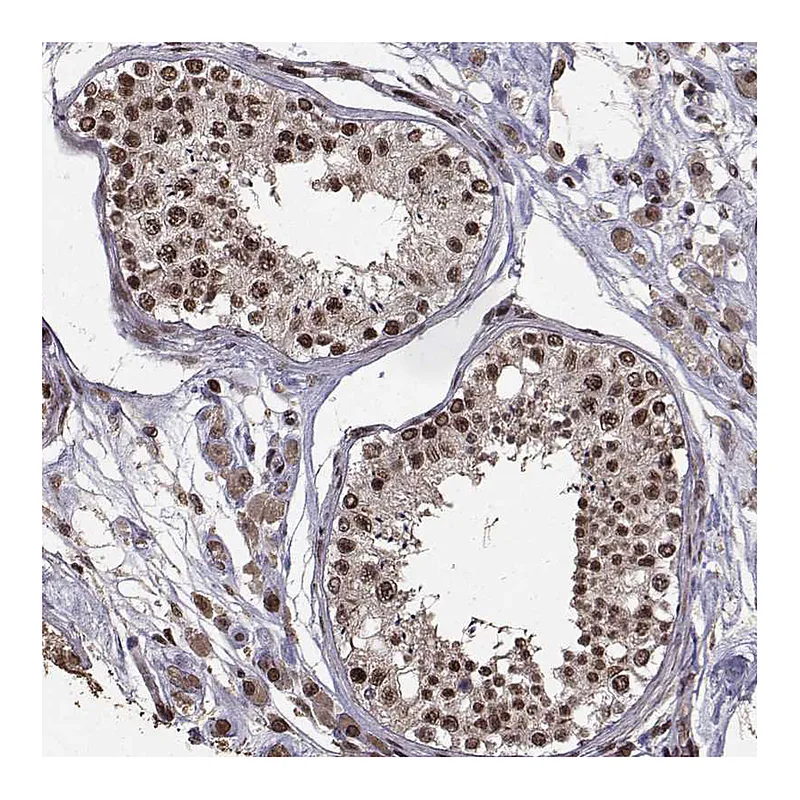 Atlas Antibodies Anti-SF1 Antibody
