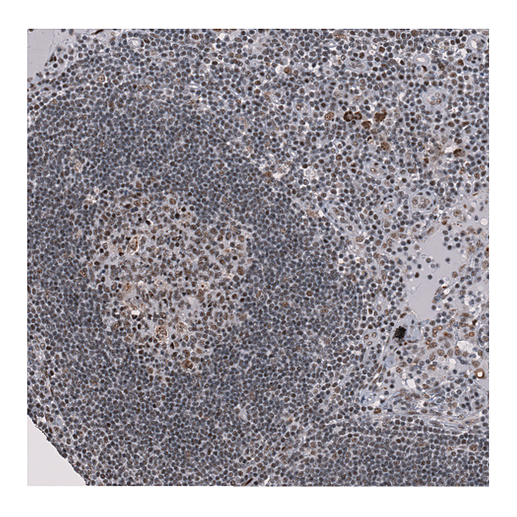 Atlas Antibodies Anti-SF3B1 Antibody