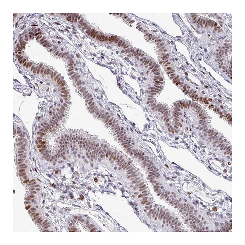 Atlas Antibodies Anti-SF3B5 Antibody