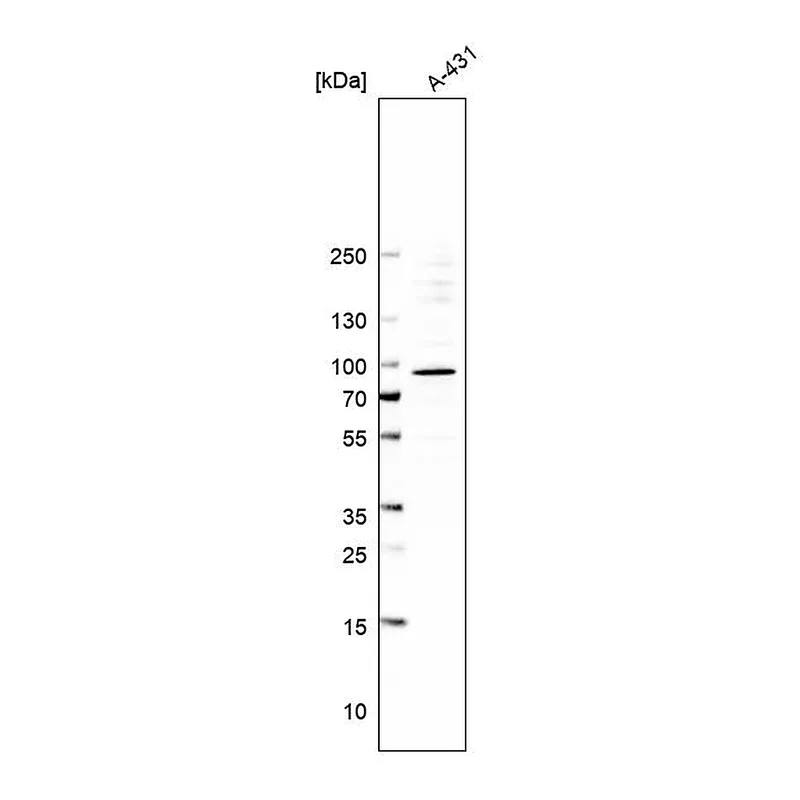 Atlas Antibodies Anti-SFMBT1 Antibody