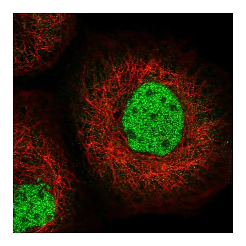 Atlas Antibodies Anti-SFMBT1 Antibody