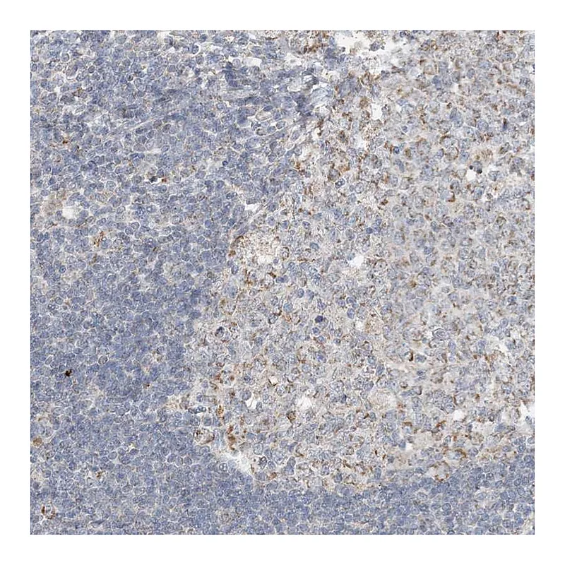 Atlas Antibodies Anti-SFMBT2 Antibody