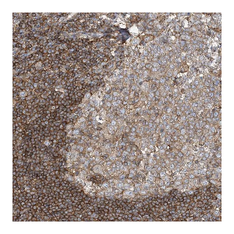 Atlas Antibodies Anti-SFMBT2 Antibody