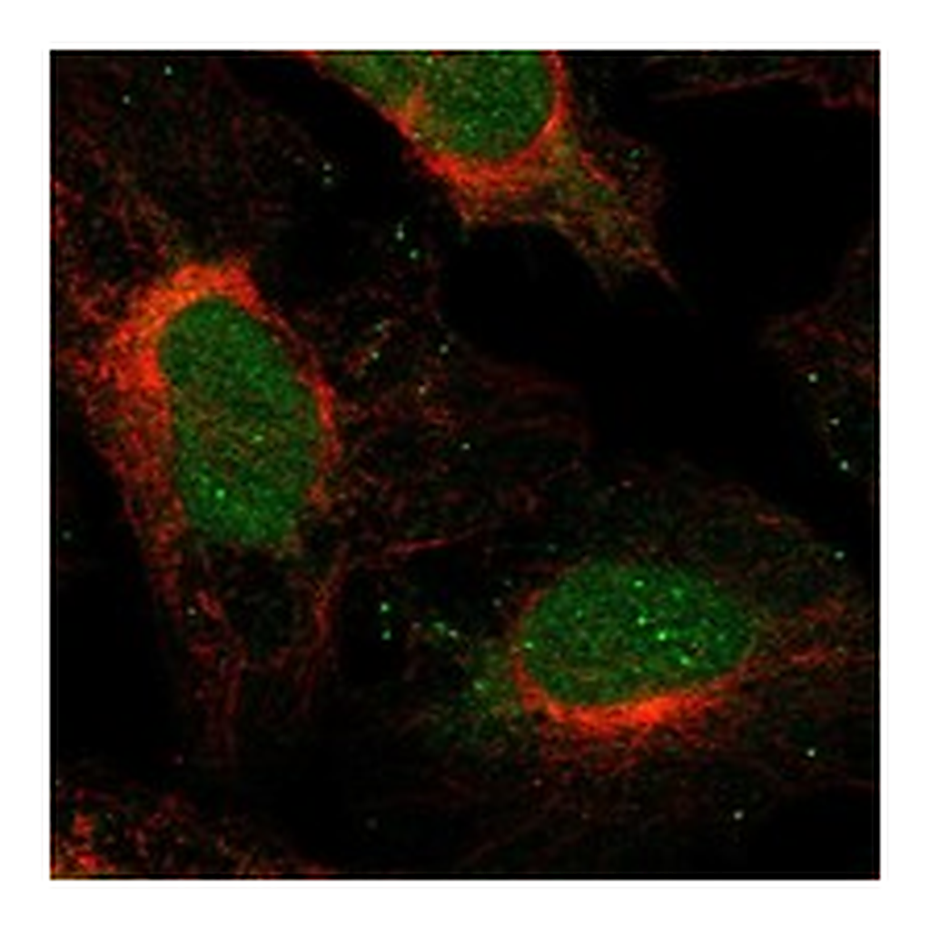 Atlas Antibodies Anti-SFMBT2 Antibody