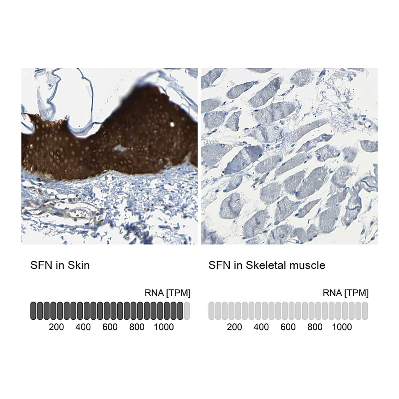 Atlas Antibodies Anti-SFN Antibody