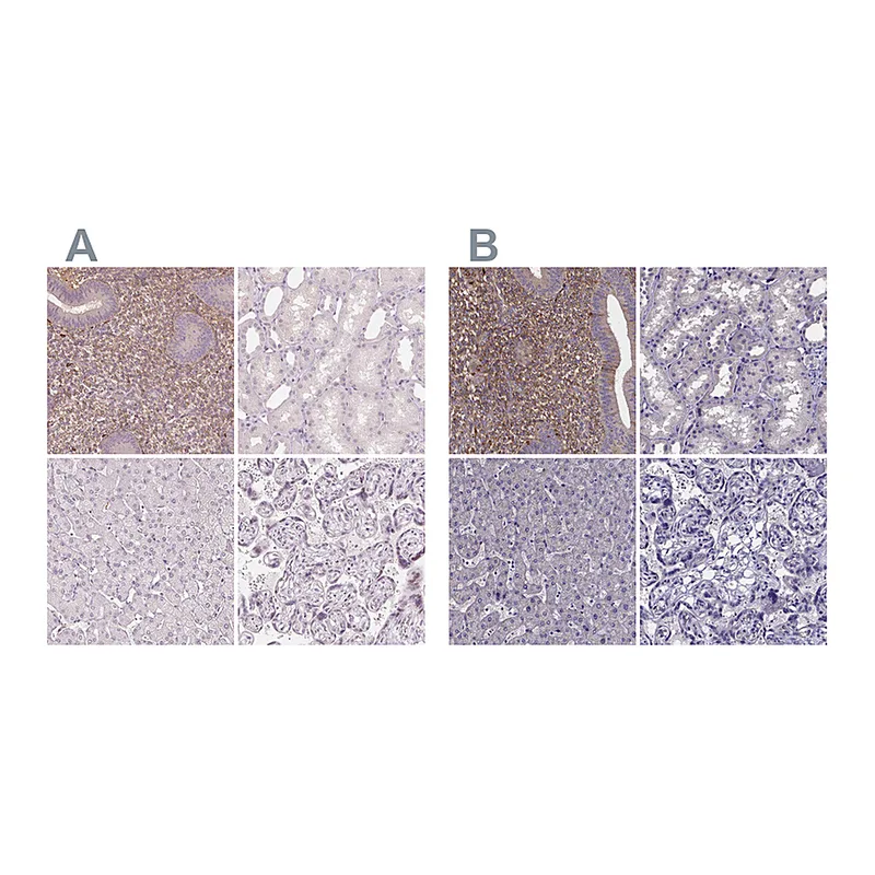 Atlas Antibodies Anti-SFRP4 Antibody