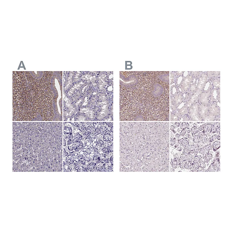 Atlas Antibodies Anti-SFRP4 Antibody