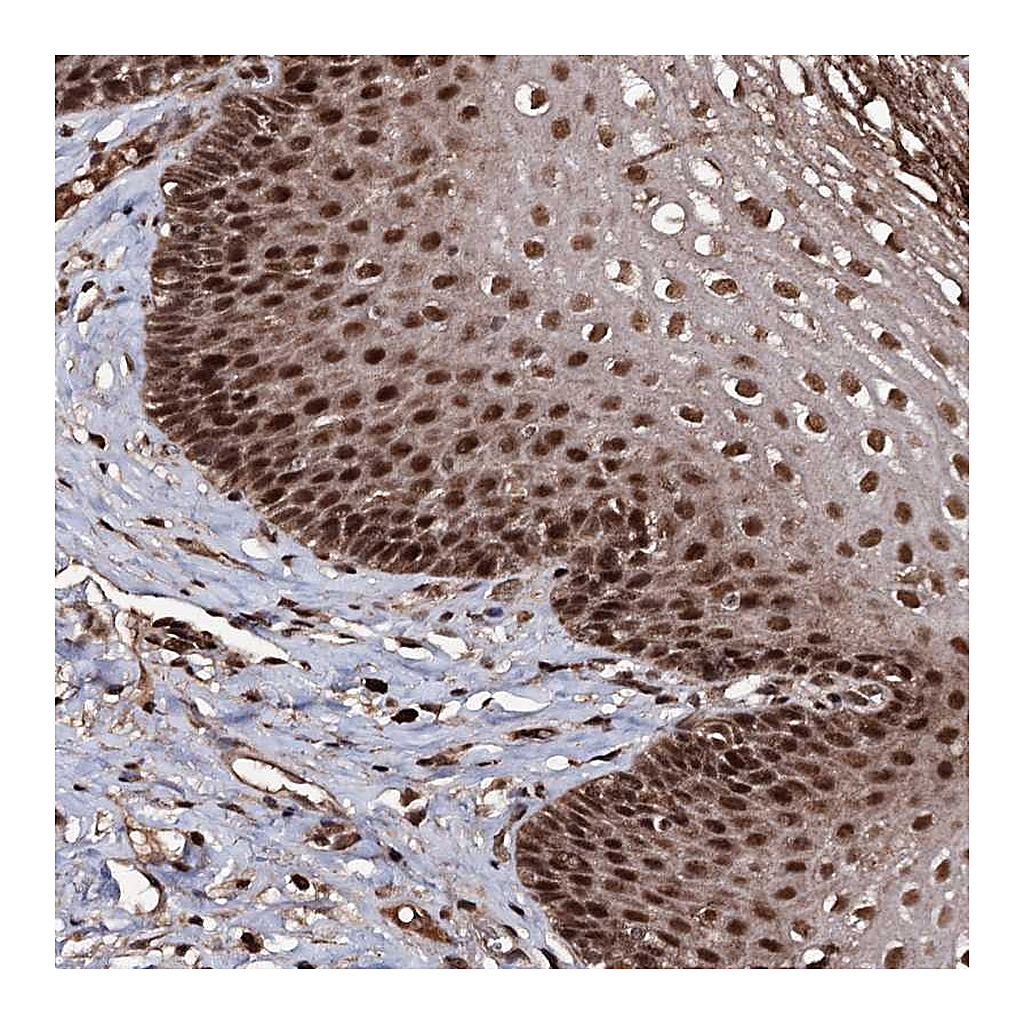 Atlas Antibodies Anti-SFSWAP Antibody