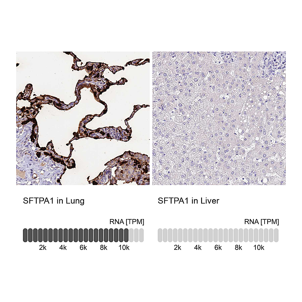 Atlas Antibodies Anti-SFTPA1 Antibody