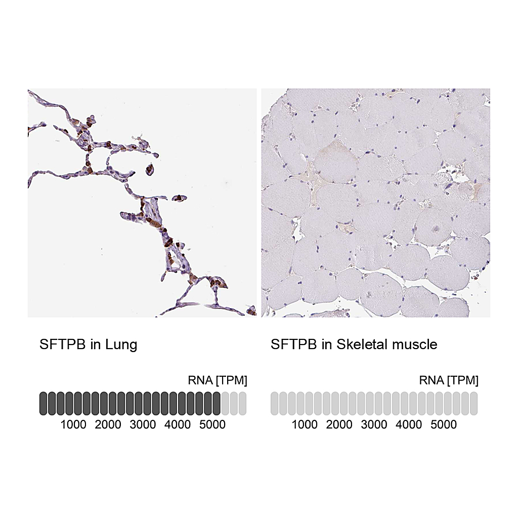 Atlas Antibodies Anti-SFTPB Antibody