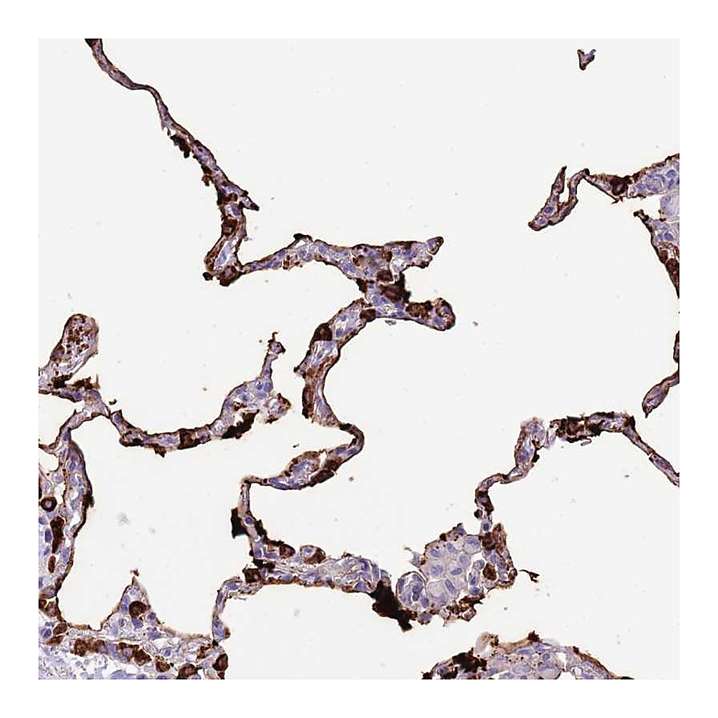 Atlas Antibodies Anti-SFTPA1 Antibody