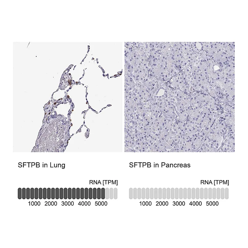 Atlas Antibodies Anti-SFTPB Antibody