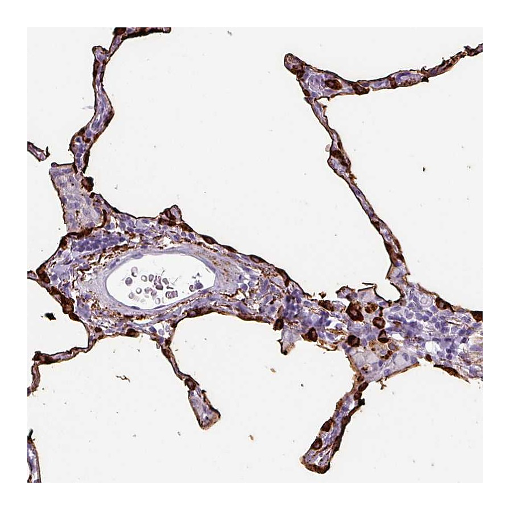 Atlas Antibodies Anti-SFTPA1 Antibody
