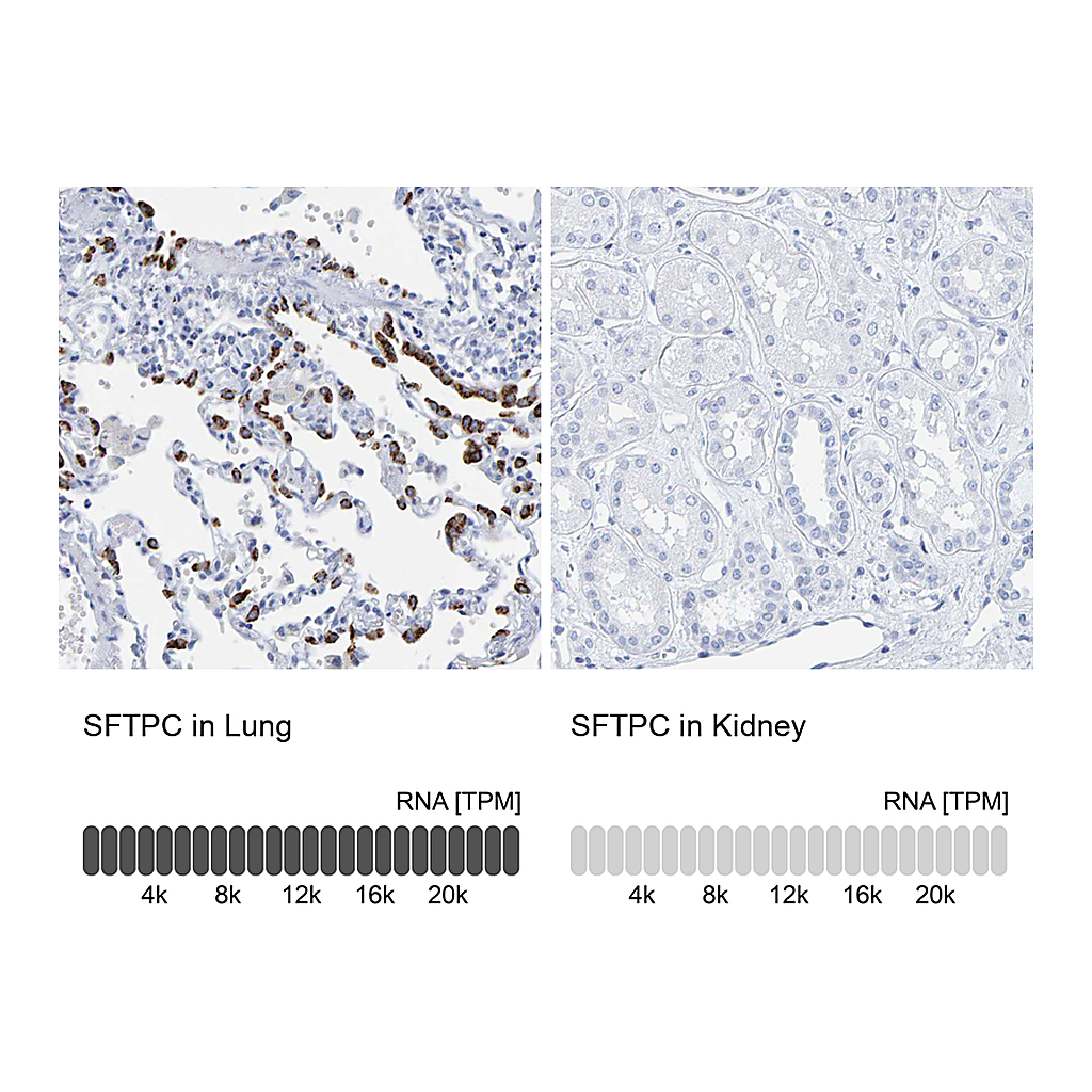 Atlas Antibodies Anti-SFTPC Antibody