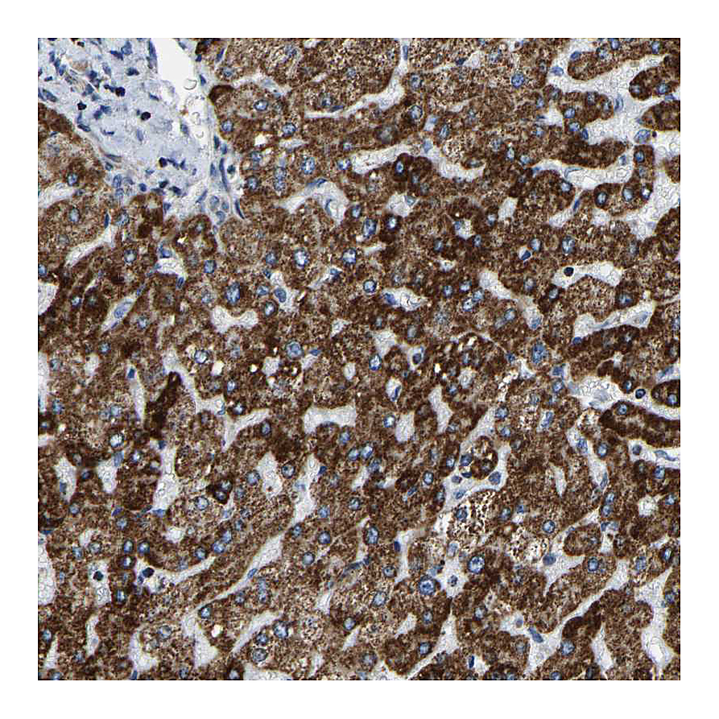 Atlas Antibodies Anti-SFXN1 Antibody