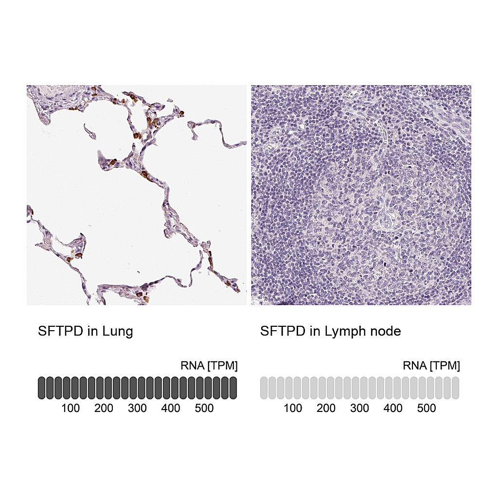 Atlas Antibodies Anti-SFTPD Antibody