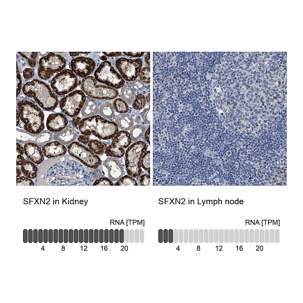 Atlas Antibodies Anti-SFXN2 Antibody