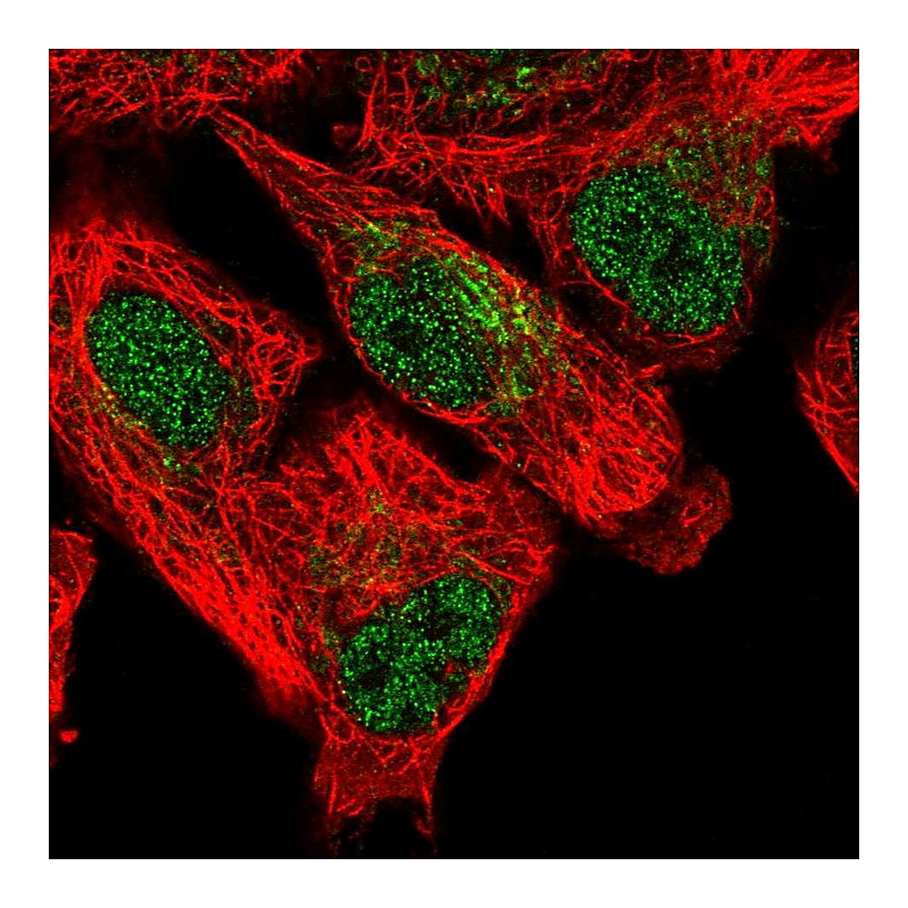 Atlas Antibodies Anti-SFXN5 Antibody