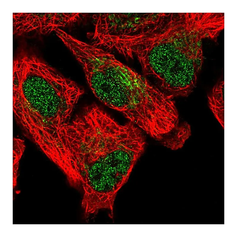 Atlas Antibodies Anti-SFXN5 Antibody
