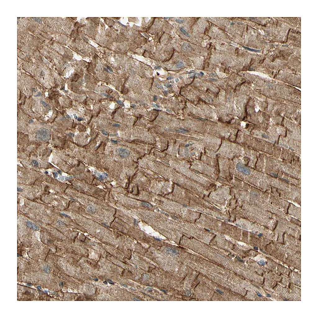 Atlas Antibodies Anti-SGCA Antibody