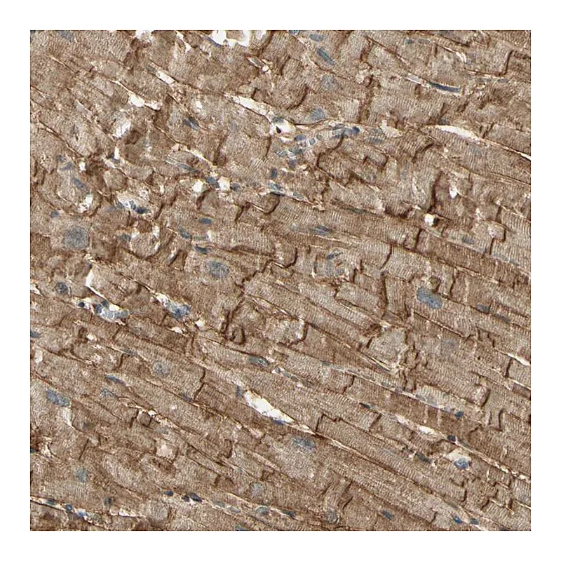 Atlas Antibodies Anti-SGCA Antibody