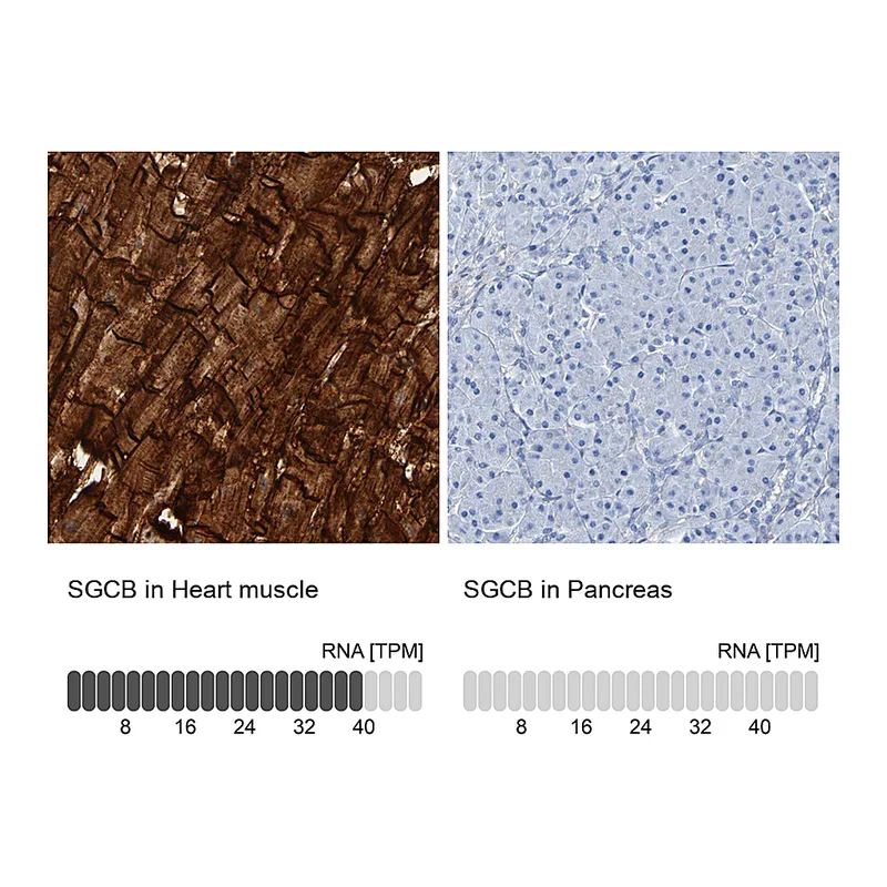 Atlas Antibodies Anti-SGCB Antibody