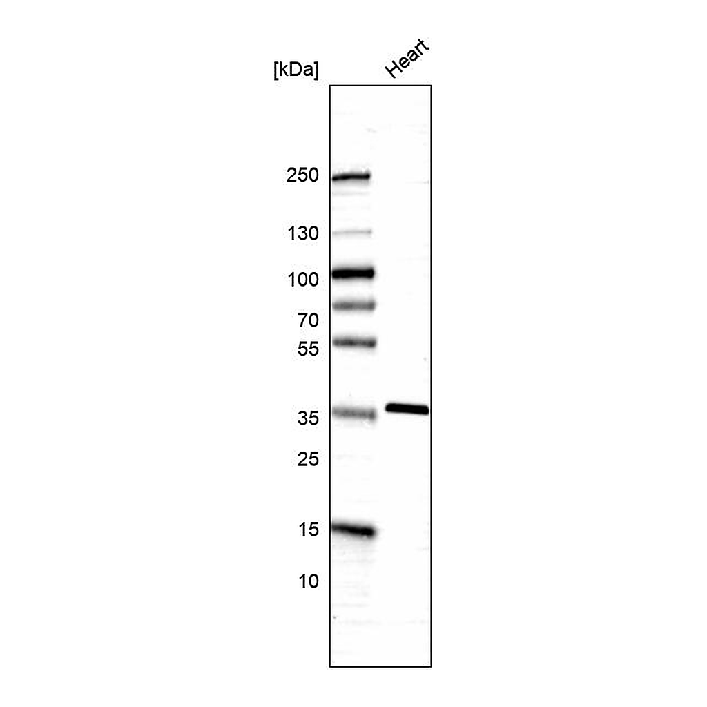 Atlas Antibodies Anti-SGCG Antibody