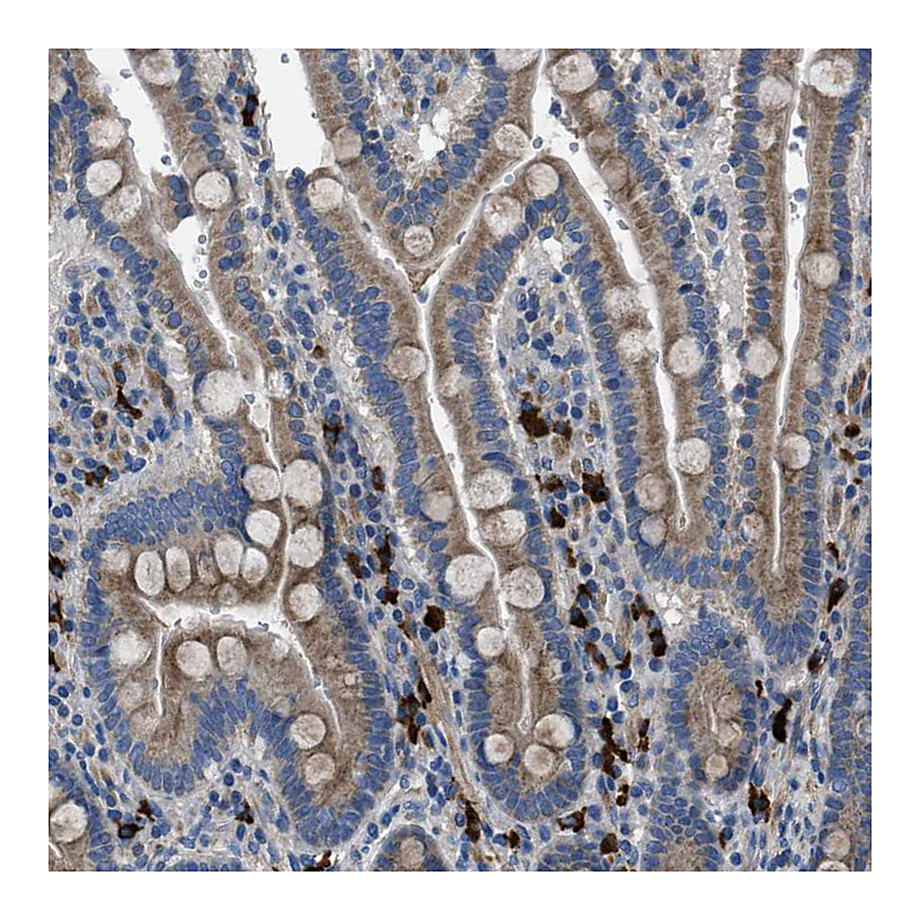 Atlas Antibodies Anti-SGCZ Antibody