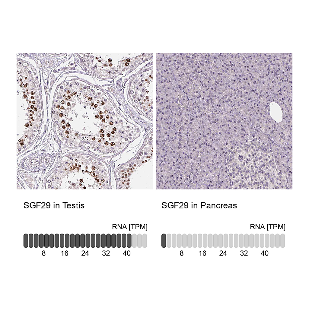 Atlas Antibodies Anti-SGF29 Antibody