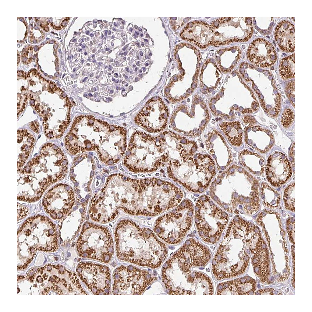 Atlas Antibodies Anti-SGF29 Antibody