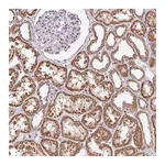 Atlas Antibodies Anti-SGF29 Antibody