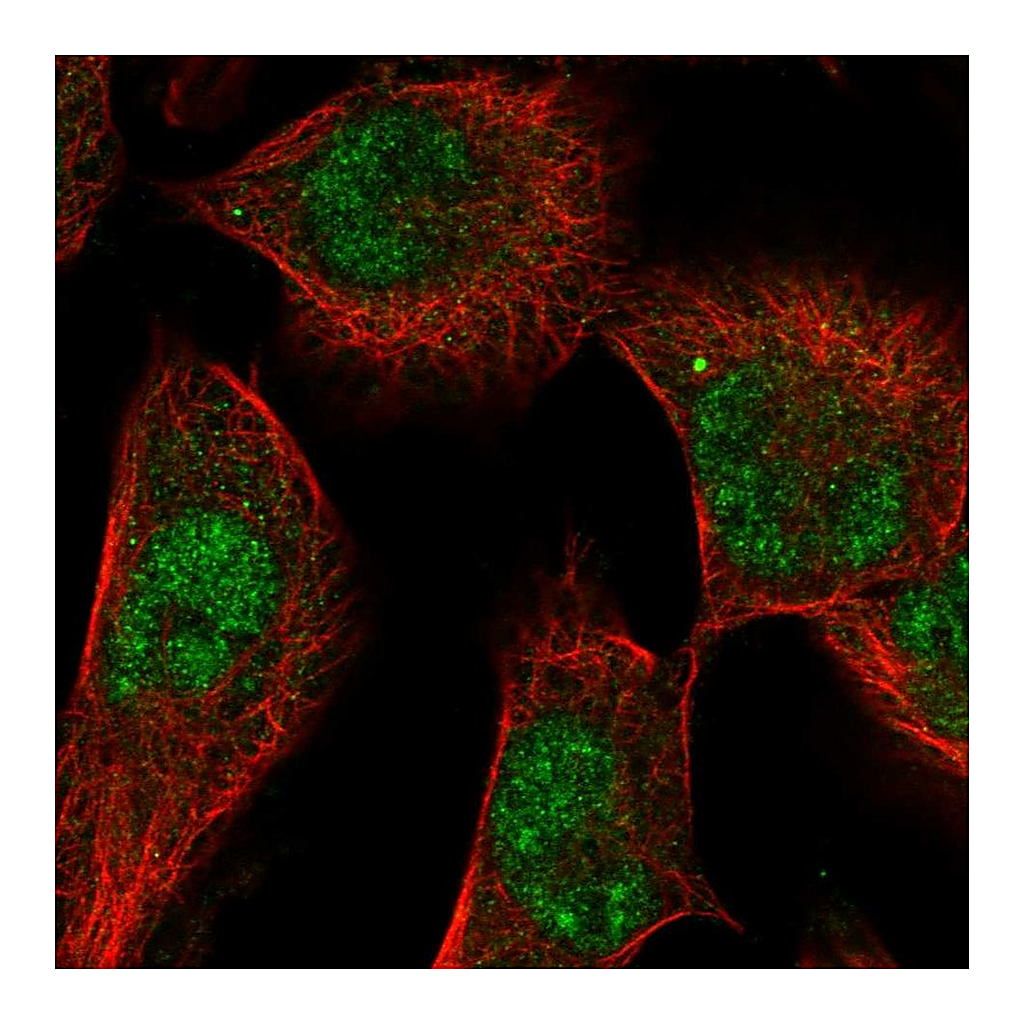 Atlas Antibodies Anti-SGK1 Antibody