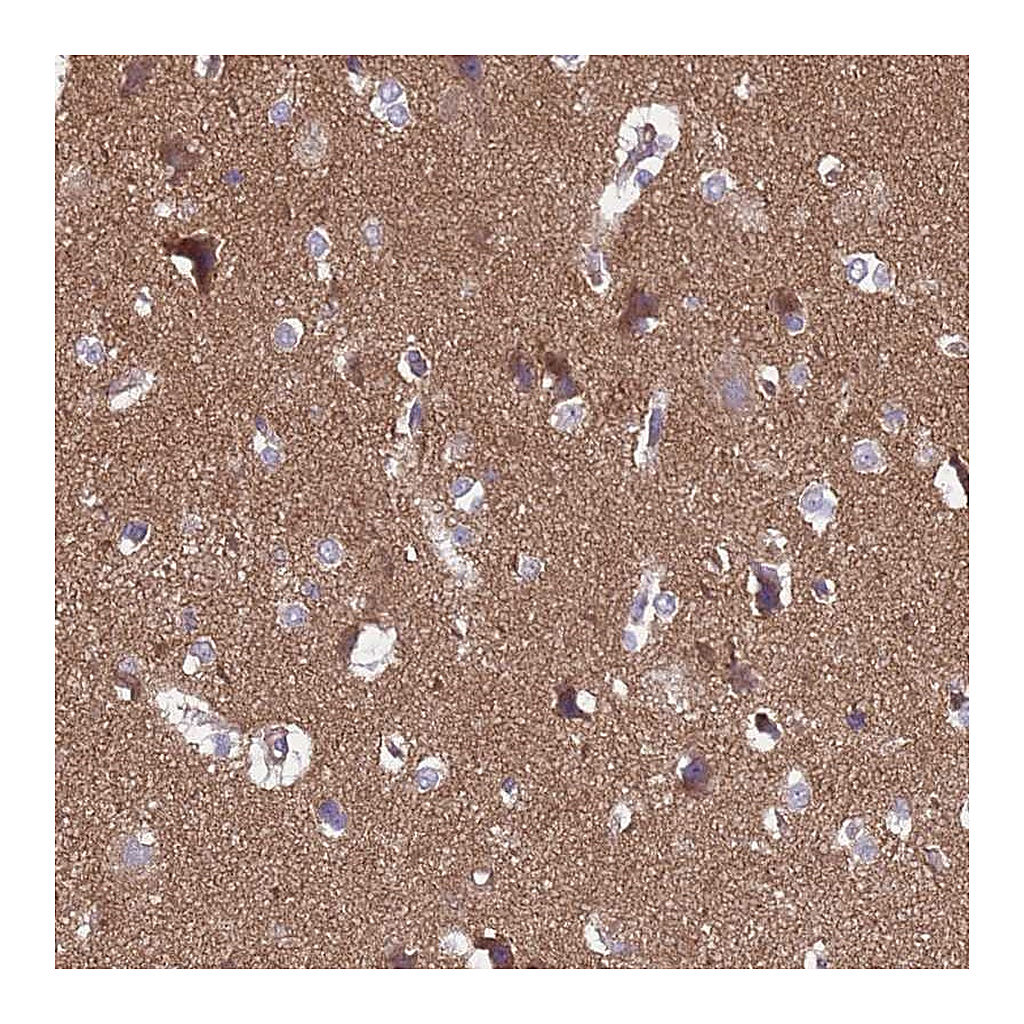Atlas Antibodies Anti-SGIP1 Antibody
