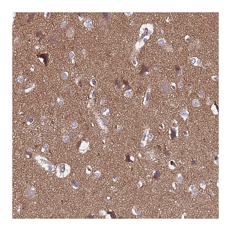 Atlas Antibodies Anti-SGIP1 Antibody
