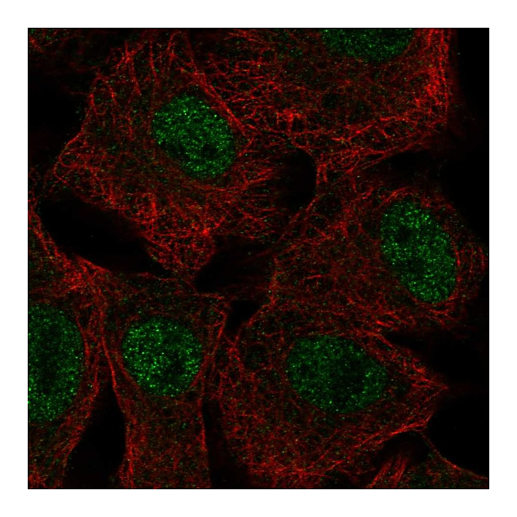 Atlas Antibodies Anti-SGK2 Antibody