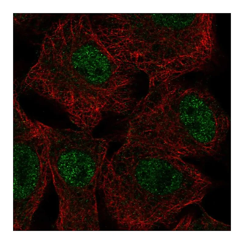 Atlas Antibodies Anti-SGK2 Antibody